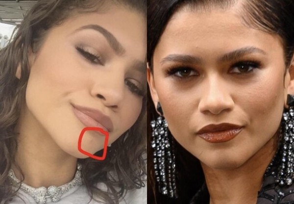 9 звезд, у которых проблемная кожа: как они за ней ухаживают