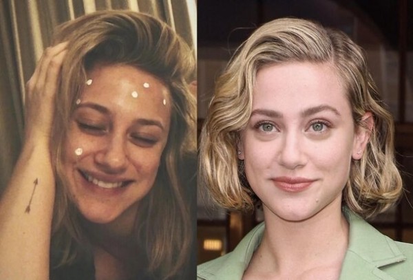 9 звезд, у которых проблемная кожа: как они за ней ухаживают