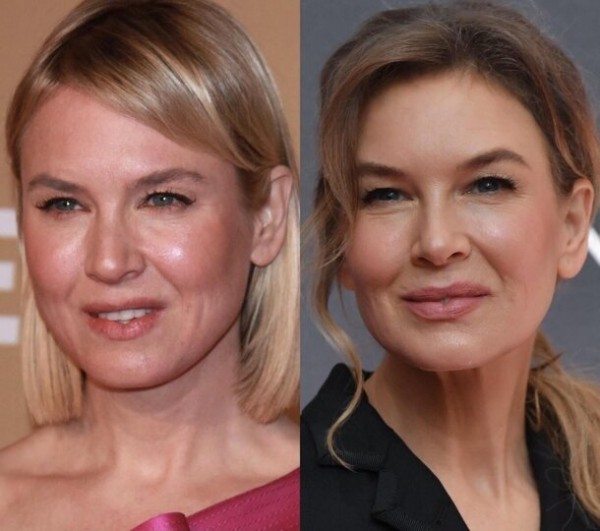 9 звезд, у которых проблемная кожа: как они за ней ухаживают