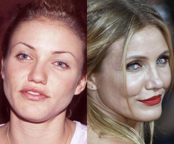 9 звезд, у которых проблемная кожа: как они за ней ухаживают