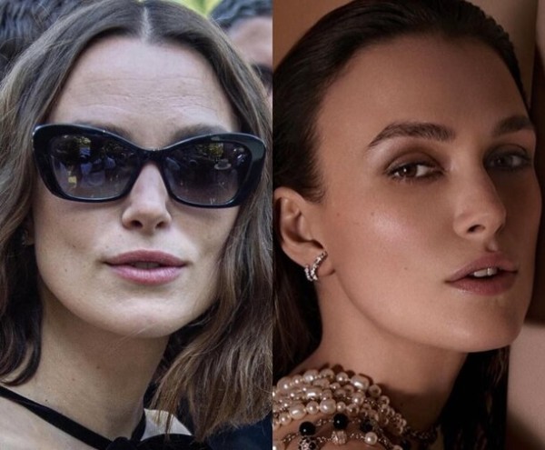 9 звезд, у которых проблемная кожа: как они за ней ухаживают