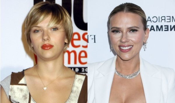 Ты ни за что не догадаешься: 7 звезд с незаметной пластикой Ты ни за что не догадаешься: 7 звезд с незаметной пластикой