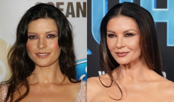 Ты ни за что не догадаешься: 7 звезд с незаметной пластикой Ты ни за что не догадаешься: 7 звезд с незаметной пластикой