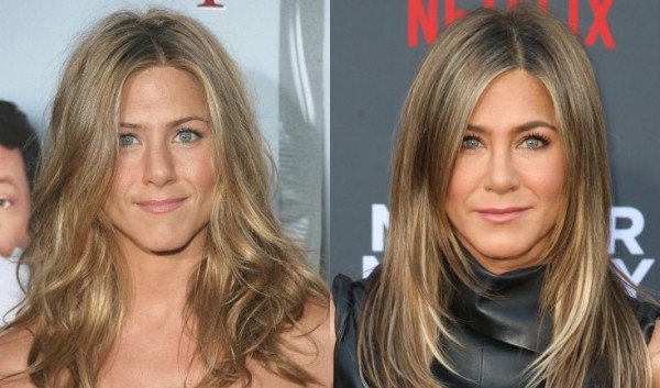 Ты ни за что не догадаешься: 7 звезд с незаметной пластикой Ты ни за что не догадаешься: 7 звезд с незаметной пластикой