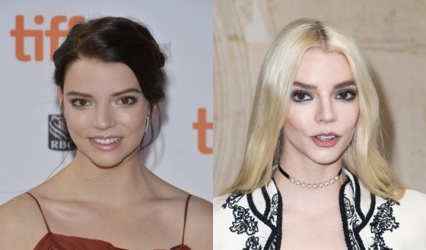 Ты ни за что не догадаешься: 7 звезд с незаметной пластикой Ты ни за что не догадаешься: 7 звезд с незаметной пластикой