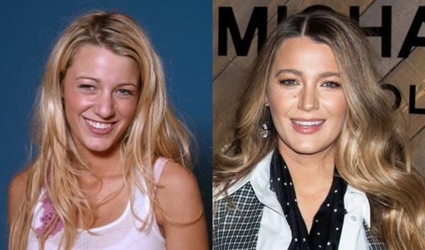 Ты ни за что не догадаешься: 7 звезд с незаметной пластикой Ты ни за что не догадаешься: 7 звезд с незаметной пластикой