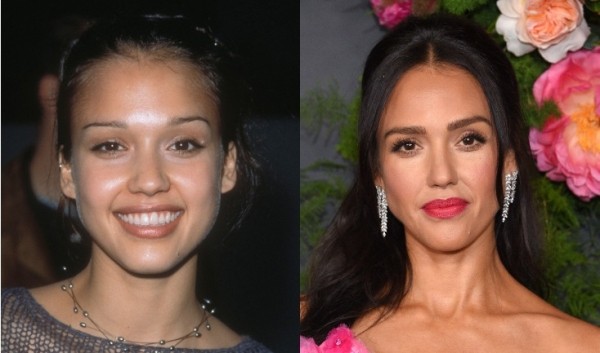 Ты ни за что не догадаешься: 7 звезд с незаметной пластикой Ты ни за что не догадаешься: 7 звезд с незаметной пластикой