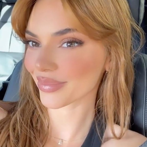 Пользователи обвинили Кендалл Дженнер в неудачной пластике губ